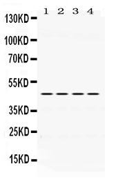 1 - Anti-PAX6 Picoband Antibody ABO12454
