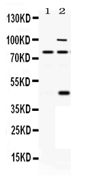 1 - Anti-PACE4 Picoband Antibody ABO12455
