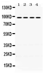 1 - Anti-ALIX Picoband Antibody ABO12456