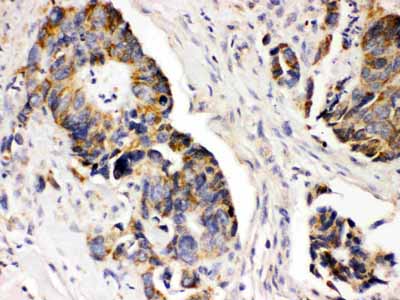 2 - Anti-PDGFRA Picoband Antibody ABO12457