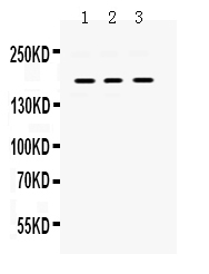 1 - Anti-PDGFRA Picoband Antibody ABO12457
