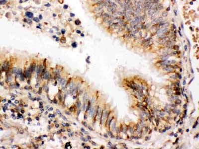 2 - Anti-ERp57 Picoband Antibody ABO12458