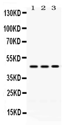 1 - Anti-PDK4 Picoband Antibody ABO12459