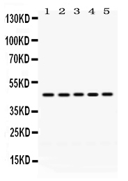 1 - Anti-PGK1 Picoband Antibody ABO12460