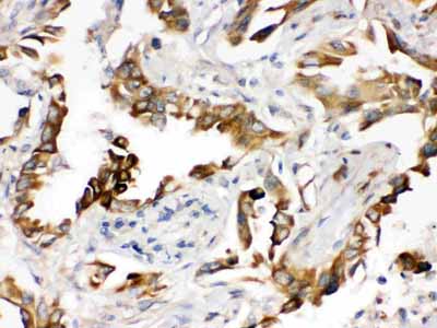 2 - Anti-PGRMC1 Picoband Antibody ABO12461