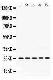 1 - Anti-PGRMC1 Picoband Antibody ABO12461