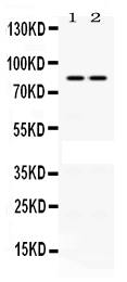 1 - Anti-PLA2G4A Picoband Antibody ABO12464