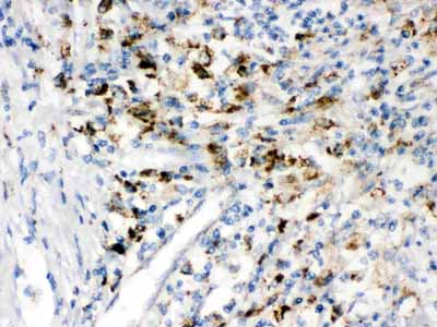 2 - Anti-PPT1 Picoband Antibody ABO12467