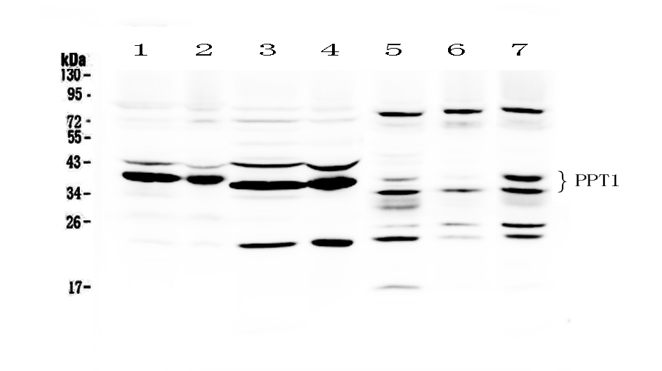 1 - Anti-PPT1 Picoband Antibody ABO12467
