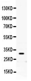 1 - Anti-PRNP Picoband Antibody ABO12469