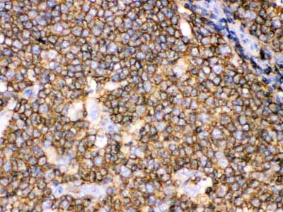 2 - Anti-CD45 Picoband Antibody ABO12471