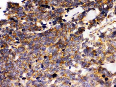 2 - Anti-LAR Picoband Antibody ABO12472