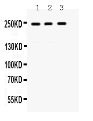 1 - Anti-LAR Picoband Antibody ABO12472