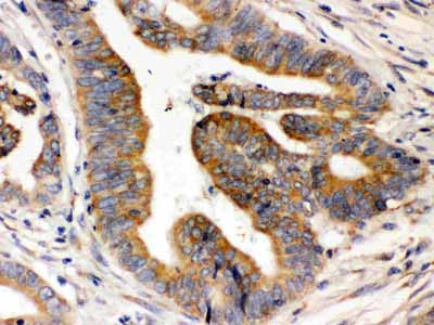 2 - Anti-Rab5 Picoband Antibody ABO12473