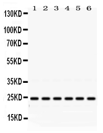 1 - Anti-Rab5 Picoband Antibody ABO12473