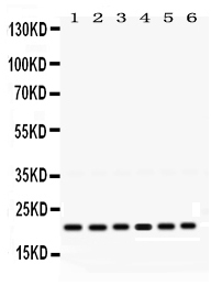 1 - Anti-RAB10 Picoband Antibody ABO12474