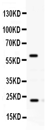 1 - Anti-Rab11A Picoband Antibody ABO12475