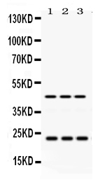1 - Anti-RAB13 Picoband Antibody ABO12476