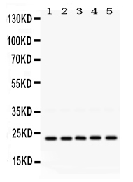 1 - Anti-Rab18 Picoband Antibody ABO12477