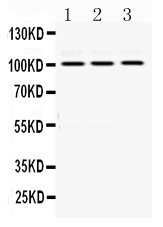 1 - Anti-RASA1 Picoband Antibody ABO12482