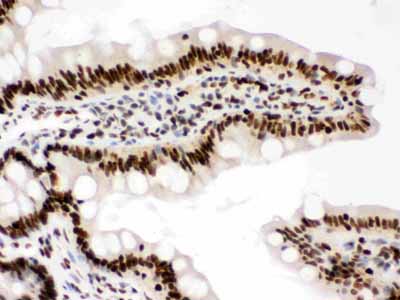 2 - Anti-RbAp48 Picoband Antibody ABO12483