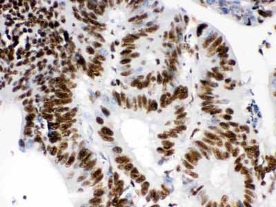 2 - Anti-RbAp48 Picoband Antibody ABO12483