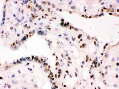 2 - Anti-RbAp48 Picoband Antibody ABO12483