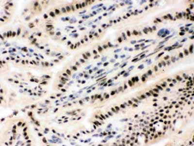2 - Anti-RbAp48 Picoband Antibody ABO12483