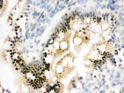 2 - Anti-RbAp48 Picoband Antibody ABO12483
