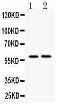 1 - Anti-DGAT1 Picoband Antibody ABO12487
