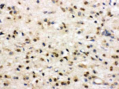 2 - Anti-PSD95 Picoband Antibody ABO12488