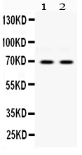1 - Anti-PKR Picoband Antibody ABO12489
