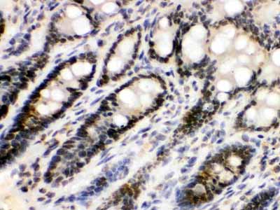 2 - Anti-EME1 Picoband Antibody ABO12490