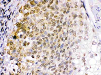 2 - Anti-EME1 Picoband Antibody ABO12490