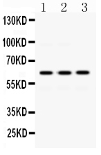 1 - Anti-EME1 Picoband Antibody ABO12490