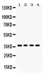 1 - Anti-FOXA3 Picoband Antibody ABO12491