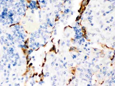 2 - Anti-Kv1.4 Picoband Antibody ABO12493