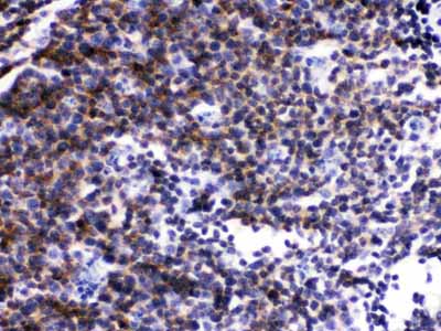 2 - Anti-Lck Picoband Antibody ABO12494