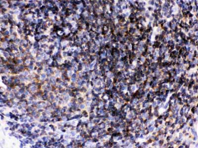 2 - Anti-Lck Picoband Antibody ABO12494