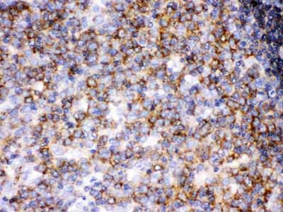 2 - Anti-Lck Picoband Antibody ABO12494