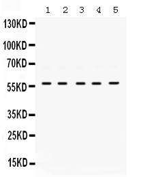 1 - Anti-Lck Picoband Antibody ABO12494