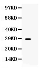 1 - Anti-Aquaporin 0 Picoband Antibody ABO12497