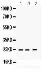 1 - Anti-RAB14 Picoband Antibody ABO12501