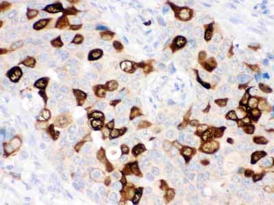 2 - Anti-RRM2 Picoband Antibody ABO12503