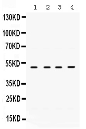1 - Anti-RRM2 Picoband Antibody ABO12503