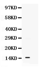 1 - Anti-S100A11 Picoband Antibody ABO12504