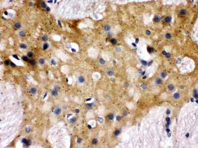 2 - Anti-Munc18-1 Picoband Antibody ABO12505
