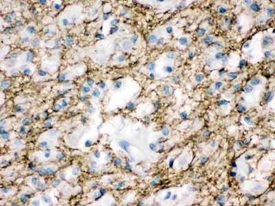 2 - Anti-Munc18-1 Picoband Antibody ABO12505