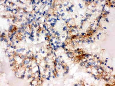 2 - Anti-SULT2A1 Picoband Antibody ABO12507