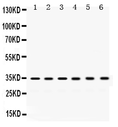 1 - Anti-SULT2A1 Picoband Antibody ABO12507